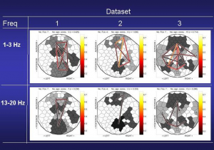 Visualization of brain connectivity networks for three subjects from high-density EEG data in two frequency bands.